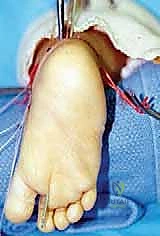 استخدام حذاء دينيس براون الطبي