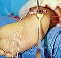 الأستاذ الدكتور محمد هطيف خبير جراحة العظام في صنعاء