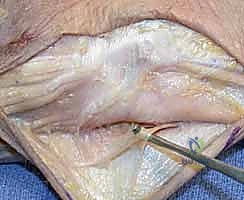 الفحص السريري وتقييم استقرار الزند