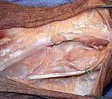 تأثير التهاب المفاصل الروماتويدي على مفصل الرسغ