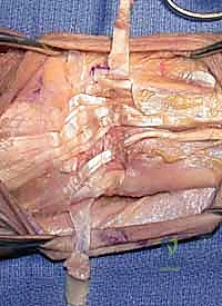 الأشعة السينية لتشخيص تشوهات مفصل الزند والكعبرة