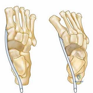 Illustration of anterior tibialis muscle - Dr. Mohammed Hutaif