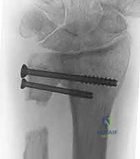 التشخيص بالأشعة السينية والمقطعية