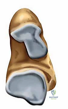 Subtalar Arthroscopy Masterclass: Comprehensive Approach to Hindfoot Pathology