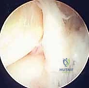 التعقيد التشريحي لمؤخرة القدم