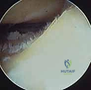 التحضير والتجهيز لعملية المنظار