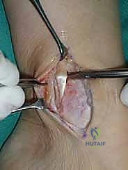 الدكتور هطيف يناقش خطة العلاج مع المريض