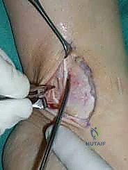 الأستاذ الدكتور محمد هطيف أثناء فحص رنين مغناطيسي