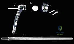 تآكل الغضروف في مفصل الزند