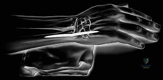 استعادة نطاق الحركة الكامل