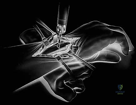 صورة رنين مغناطيسي للرسغ