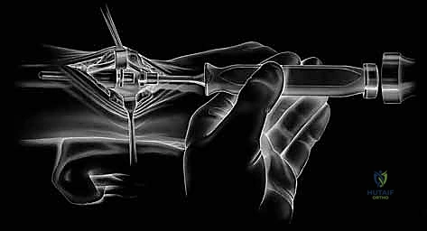 جبيرة ما بعد الجراحة