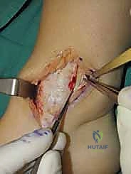 ميكانيكا مفصل الكاحل