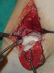 فحص الكاحل السريري