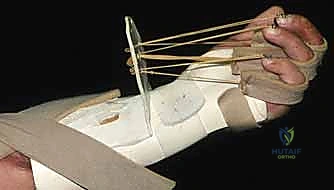 إزالة المواد السامة من داخل اليد