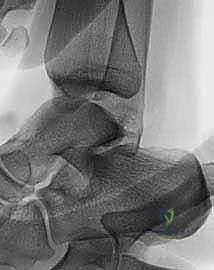 التشريح الهيكلي لأربطة الكاحل