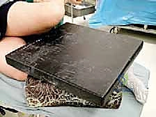 تأثير الالتواء على الأربطة