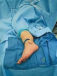 صناعة بيئة مثالية للالتئام