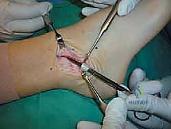 تقييم الأشعة السينية في العيادة