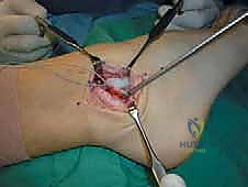 رؤية واضحة لموقع الإصابة