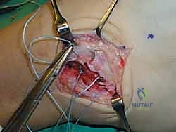 اختبار قوة ثبات الخطاف