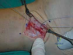 الأستاذ الدكتور محمد هطيف أثناء الفحص