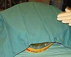 صورة توضيحية لآلية الإصابة