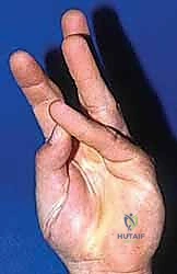 Intraoperative Surgical Step