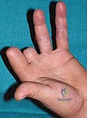 Intraoperative Surgical Step