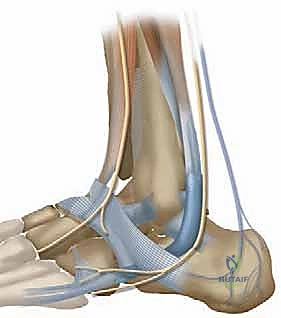 تشريح الأربطة الجانبية للكاحل وأهميتها في الثبات