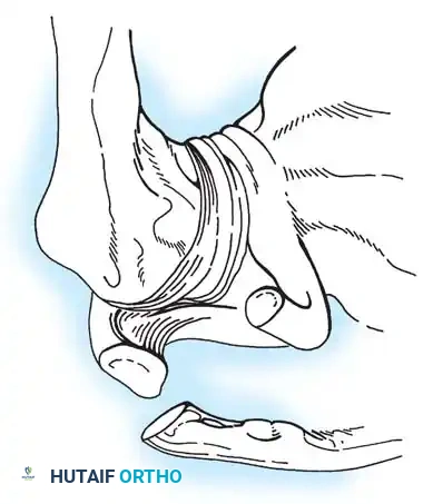 ACROMIOCLAVICULAR JOINT Surgical Diagram