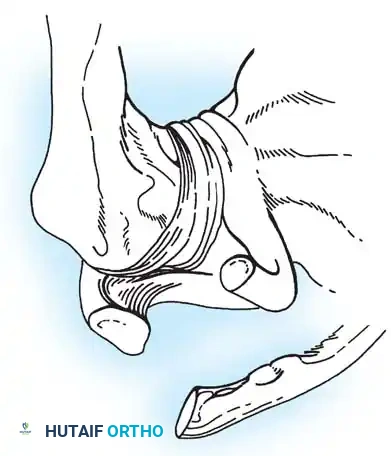 ACROMIOCLAVICULAR JOINT Surgical Diagram