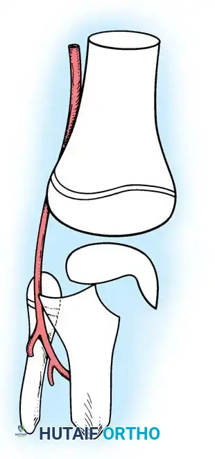 Popliteal arterty