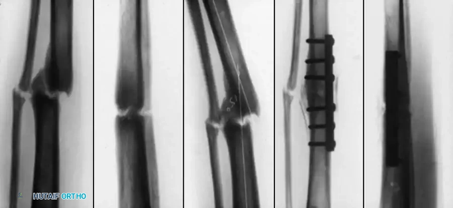 Hutaifortho's Orthopaedic Diagram