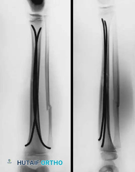 Hutaifortho's Orthopaedic Diagram