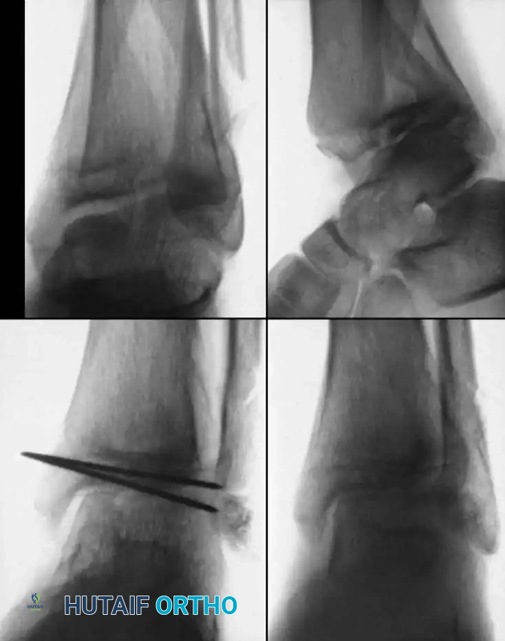 Hutaifortho's Orthopaedic Diagram