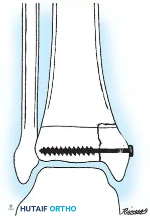 Hutaifortho's Orthopaedic Diagram