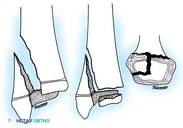 Hutaifortho's Orthopaedic Diagram