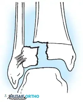 Hutaifortho's Orthopaedic Diagram