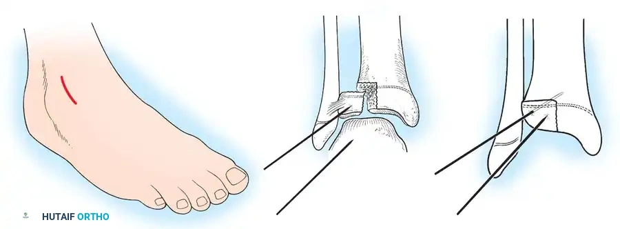 Hutaifortho's Orthopaedic Diagram