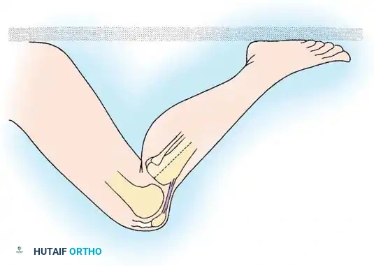 Hutaifortho's Orthopaedic Diagram