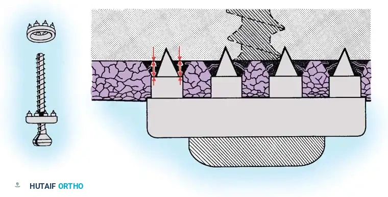 Hutaifortho's Orthopaedic Diagram
