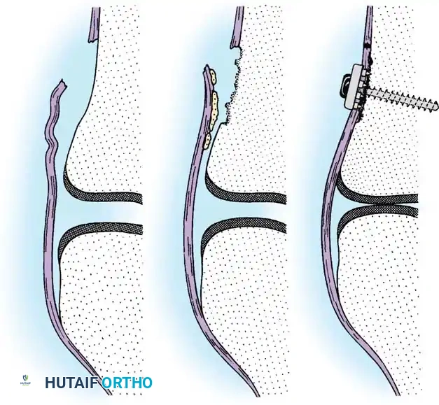 Hutaifortho's Orthopaedic Diagram