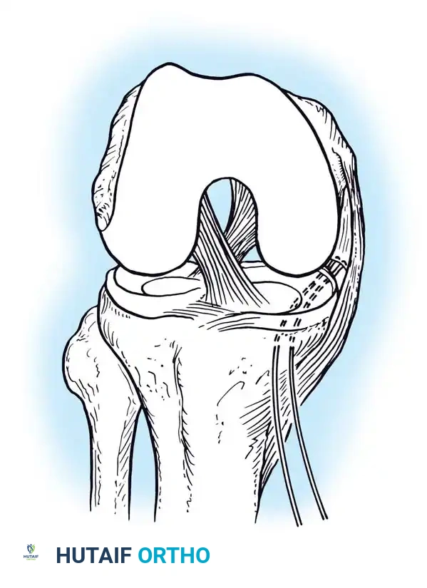 Hutaifortho's Orthopaedic Diagram