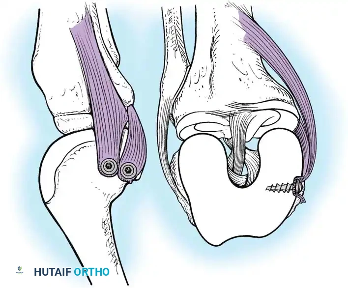 Hutaifortho's Orthopaedic Diagram