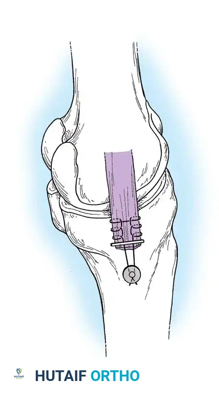 Hutaifortho's Orthopaedic Diagram
