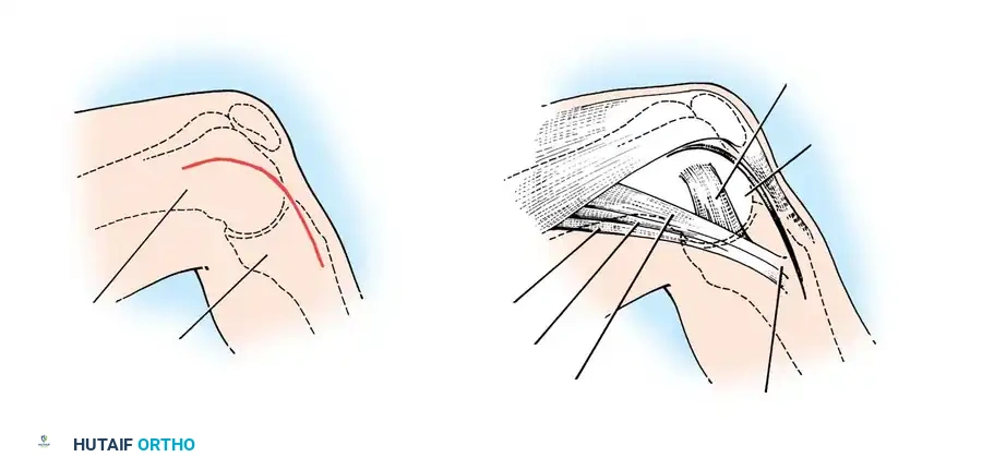 Hutaifortho's Orthopaedic Diagram