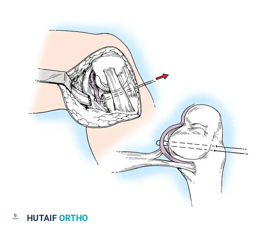 Hutaifortho's Orthopaedic Diagram