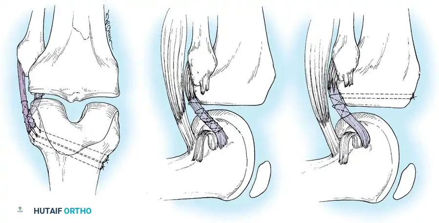 Hutaifortho's Orthopaedic Diagram