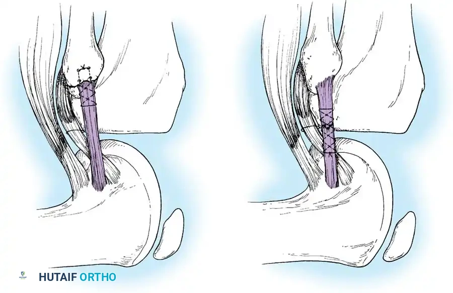 Hutaifortho's Orthopaedic Diagram